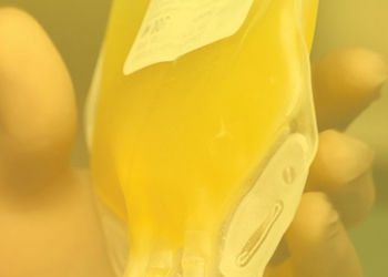 What Is a Normal Platelet Count?