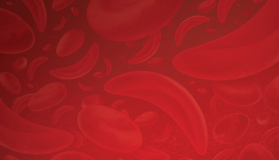 World Sickle Cell Day: Meet Alexandra