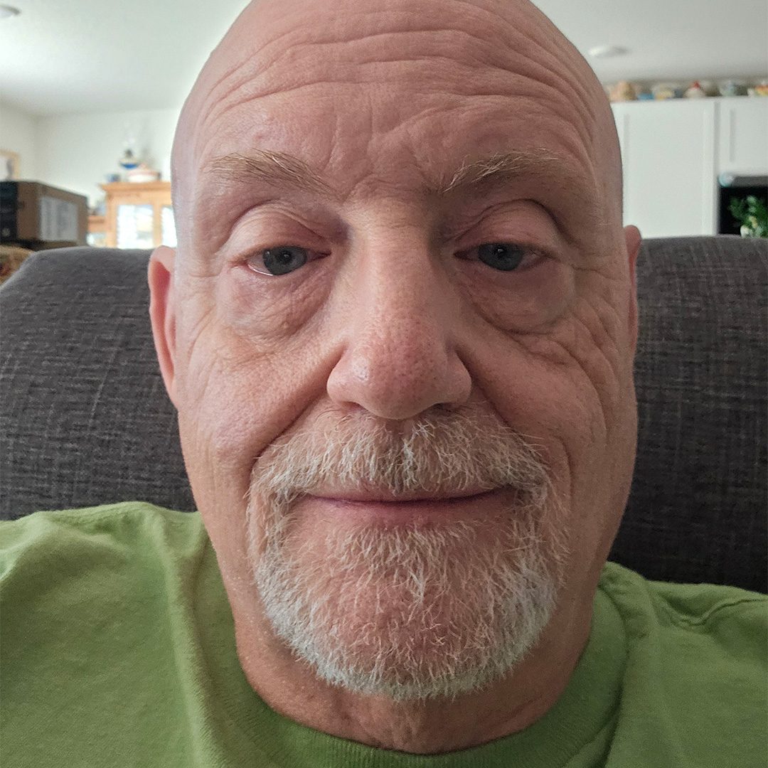 Placeholder Image